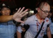 policeman-with-injured-hong-kong-protestor